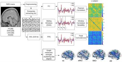 Increased functional connectivity patterns in mild Alzheimer’s disease: A rsfMRI study